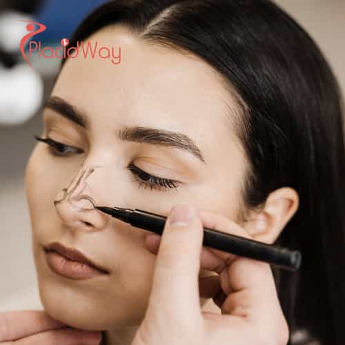 Revision Rhinoplasty in South Korea for Chinese Patients